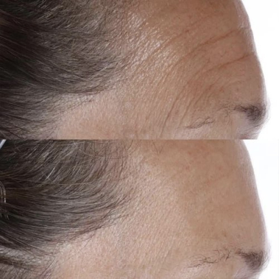 Олія для обличчя з інтенсивною формулою та екстрактом чіа Perricone MD Essential Fx Acyl-Glutathione Chia Oil 4.5 ml